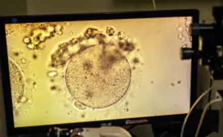 IVF generated embryo